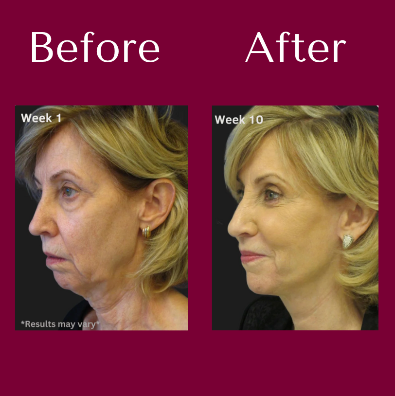 Elora NAD+ Supplement for Women