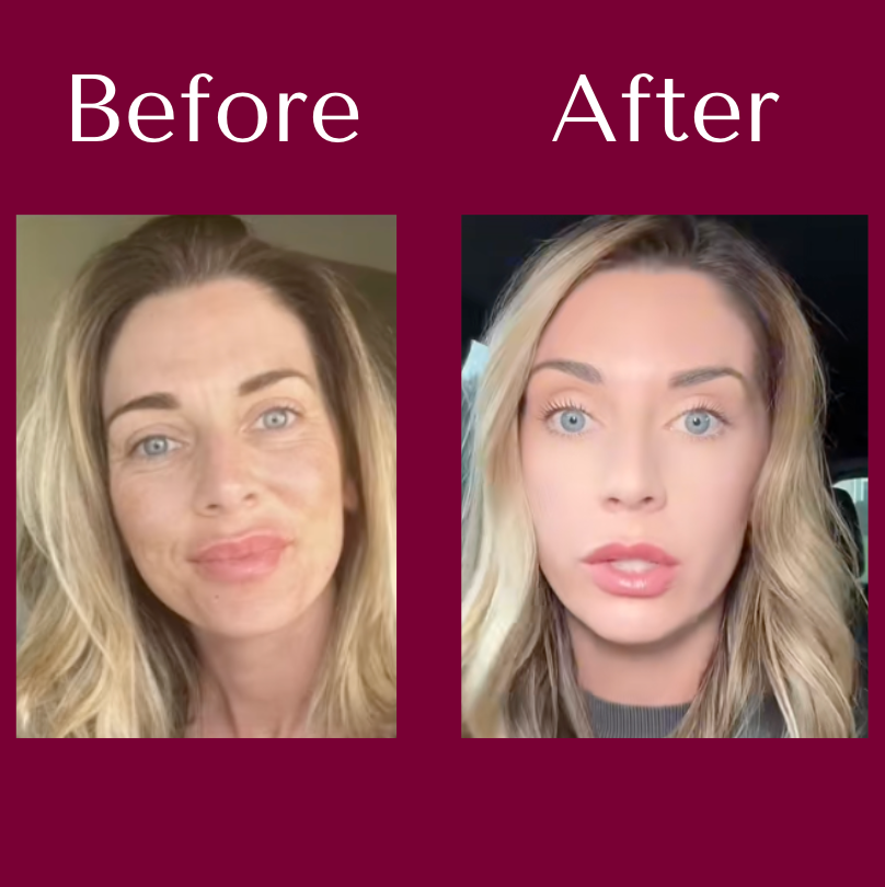 Elora NAD+ Supplement for Women